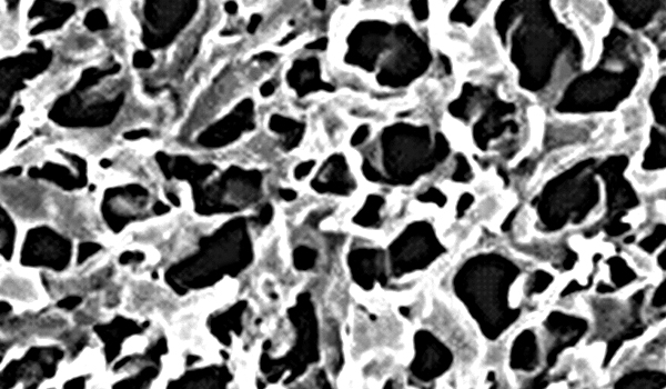 detalle de la membrana filtrante de polivinilideno dorsan